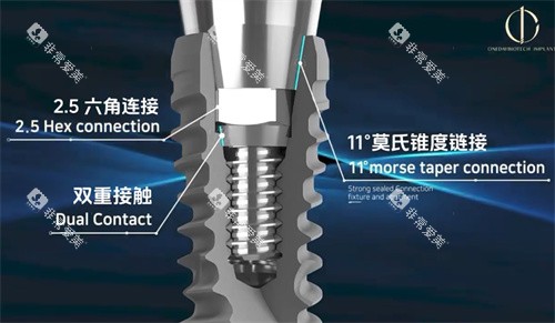 韩一种植牙优势介绍