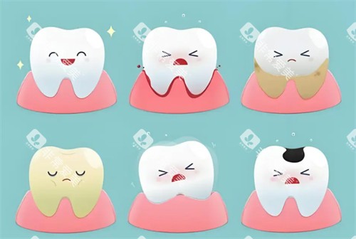 健康牙齿与不健康牙齿的状态