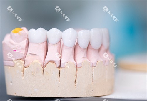 牙齿模型图展示图片
