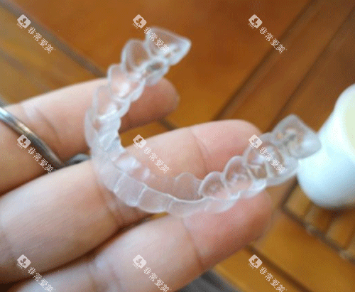 隐形牙齿矫正牙套图