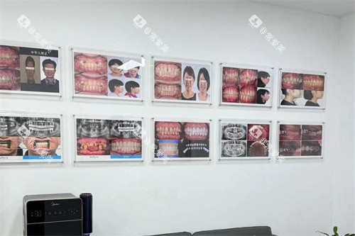 沈阳全家口腔病例展示