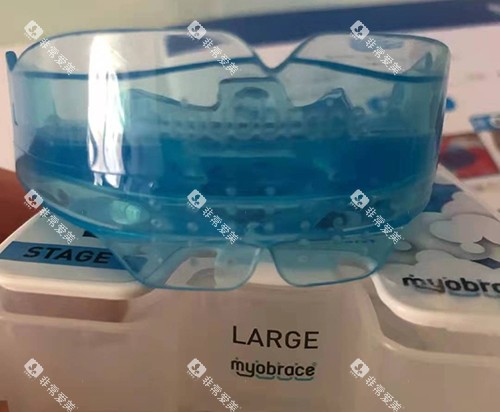 牙齿矫正MRC早期肌功能矫正器2