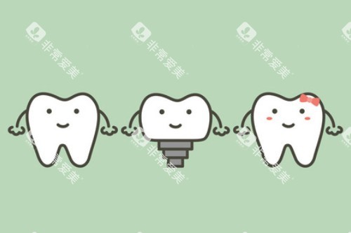 单颗种植牙卡通展示图