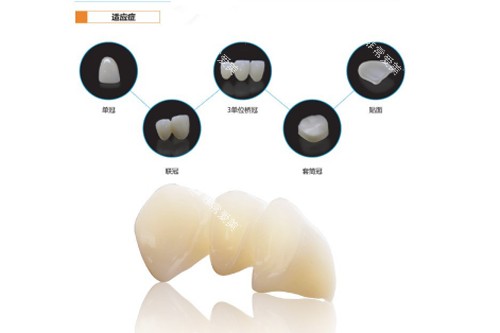 氧化锆玉瓷TT牙冠适应症图