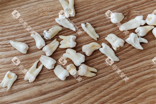 义齿材料模型图