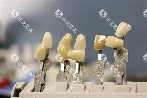 义齿材料展示