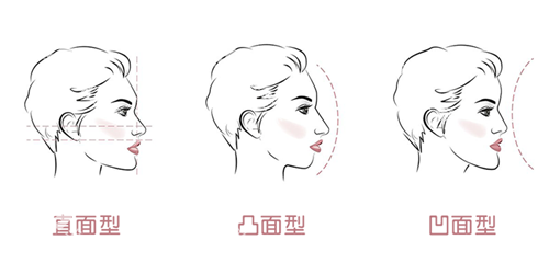 牙齿矫正面型问题