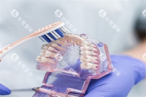 假牙模型清洗图片