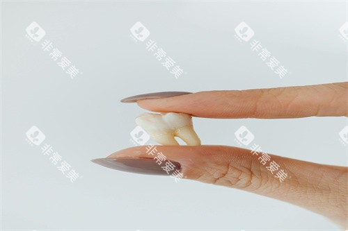 假牙模型图片展示