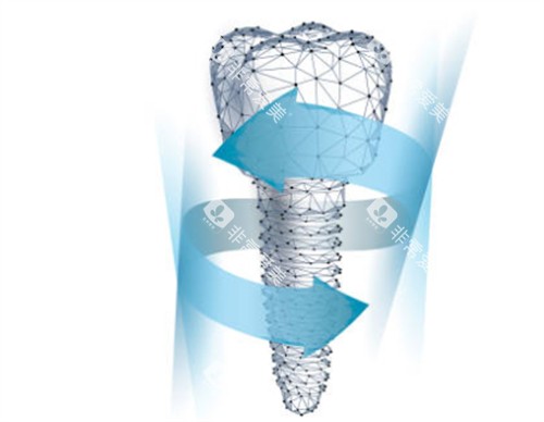 种植牙模型卡通图