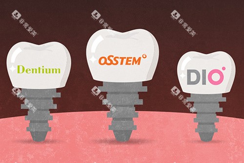 韩国种植体品牌示意图