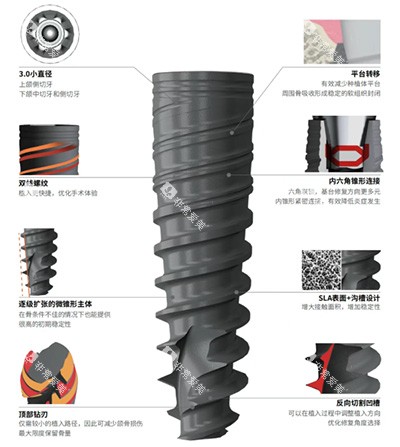 百齿泰泰锆3.0种植牙怎么样