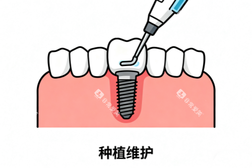 种植牙维护卡通图
