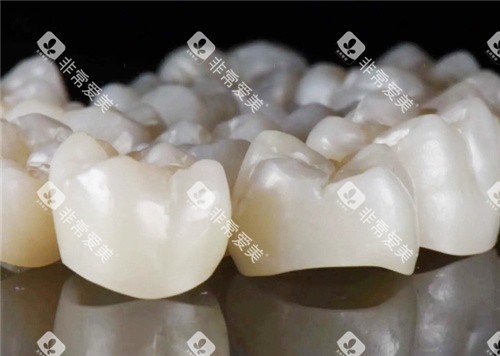 威兰德全瓷牙图示