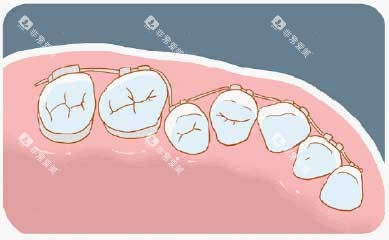 牙齿矫正漫画牙齿图 牙齿矫正漫画牙齿图