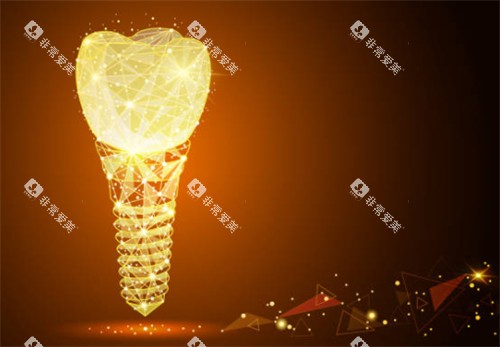 种植牙科技感背景图 种植牙科技感背景图