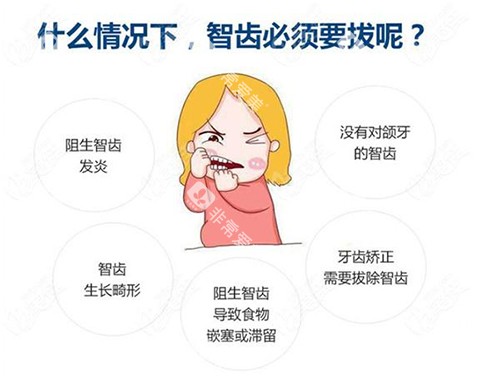 拔智齿的不同情况 拔智齿的不同情况