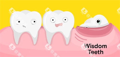 下颌智齿萌出 下颌智齿萌出