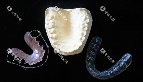 牙齿矫正模型图