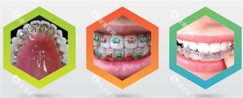 三种不同牙齿矫正牙套示意图