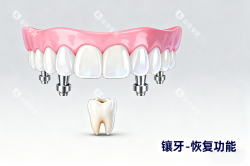 镶牙卡通图片一览