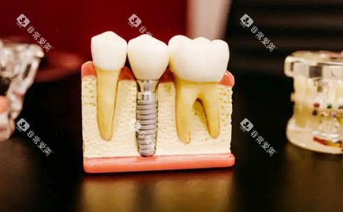 武汉诺洁口腔牙齿模型实拍图