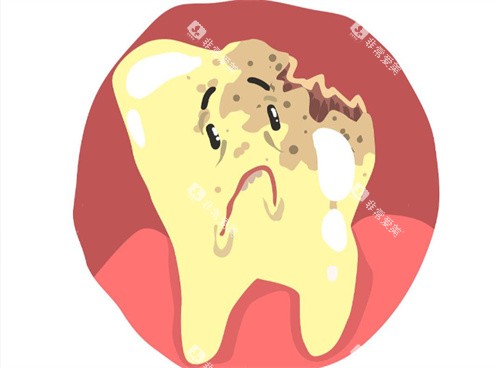 龋齿卡通 龋齿卡通