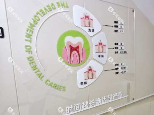 苏州昆山爱牙口腔龋齿程度示意图 苏州昆山爱牙口腔龋齿程度示意图