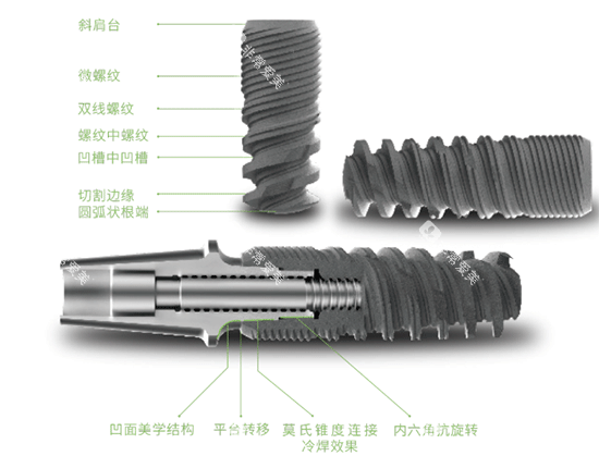 科惠种植牙种植体照片 科惠种植牙种植体照片