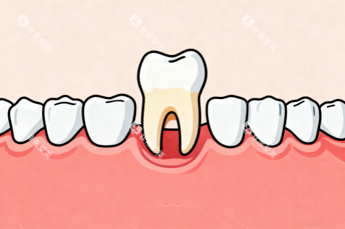 拔牙卡通图 拔牙卡通图
