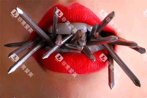 牙齿宣传图展示