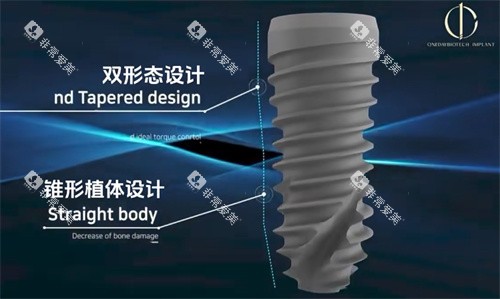 韩一种植牙优点图