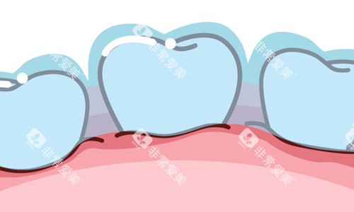 保护牙齿重要性