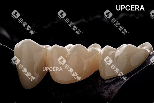 瓷倍健全瓷牙图示 瓷倍健全瓷牙图示
