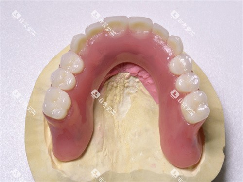 牙齿假牙模型