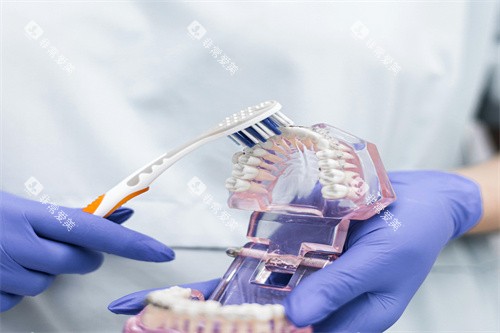 牙齿模型清洗 牙齿模型清洗