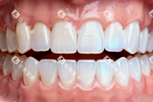 整齐健康牙齿模型图