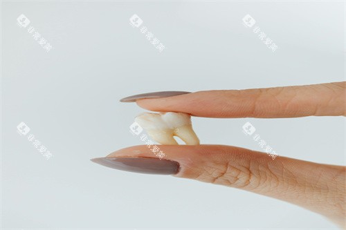 假牙模型图片展示