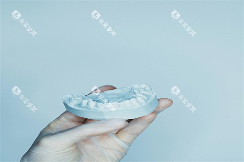 假牙制作模型图片