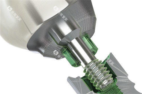 美国百好瑞种植牙植体连接处放大