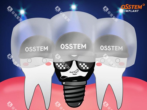 奥齿泰种植牙卡通图