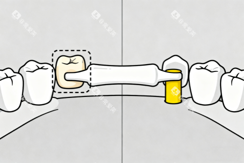 镶牙卡通展示图