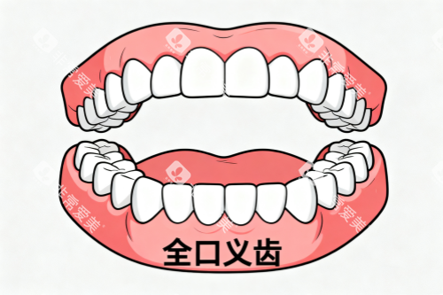 全口假牙卡通图