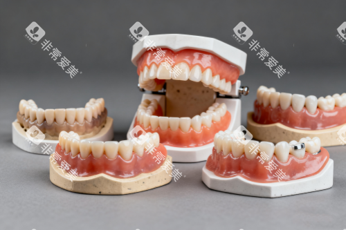 假牙模型图片展示
