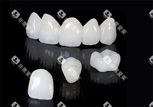 不同位置的全瓷牙