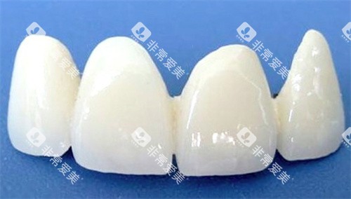 全瓷牙