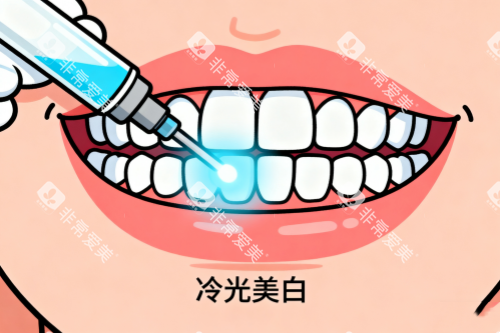 牙齿冷光美白卡通图