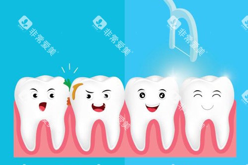 洗牙示意图