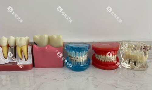 牙齿各种模具图