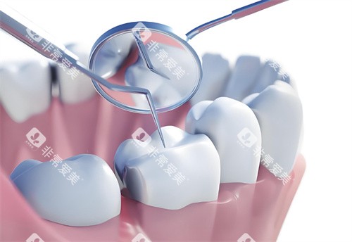 牙齿检查卡通图展示